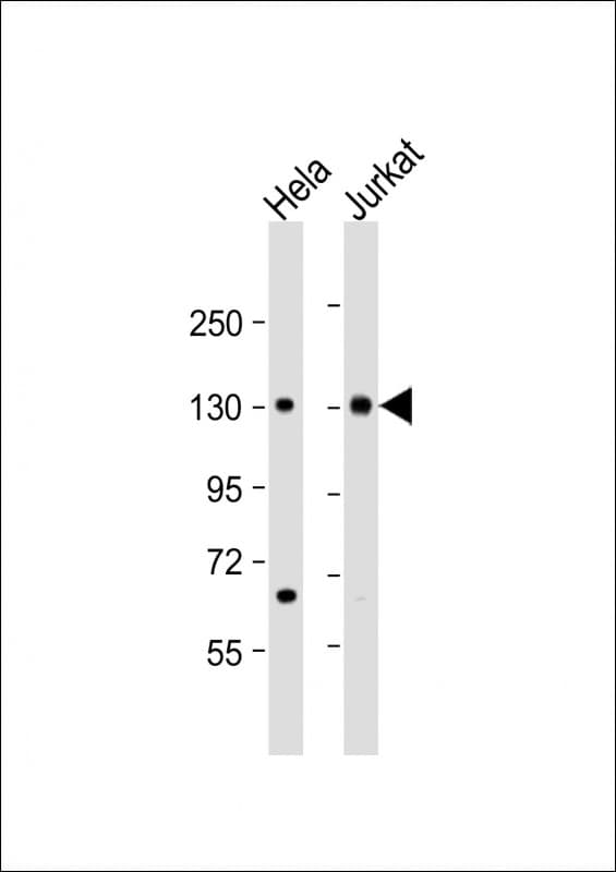 MTUS1 Antibody (aa983-1017)