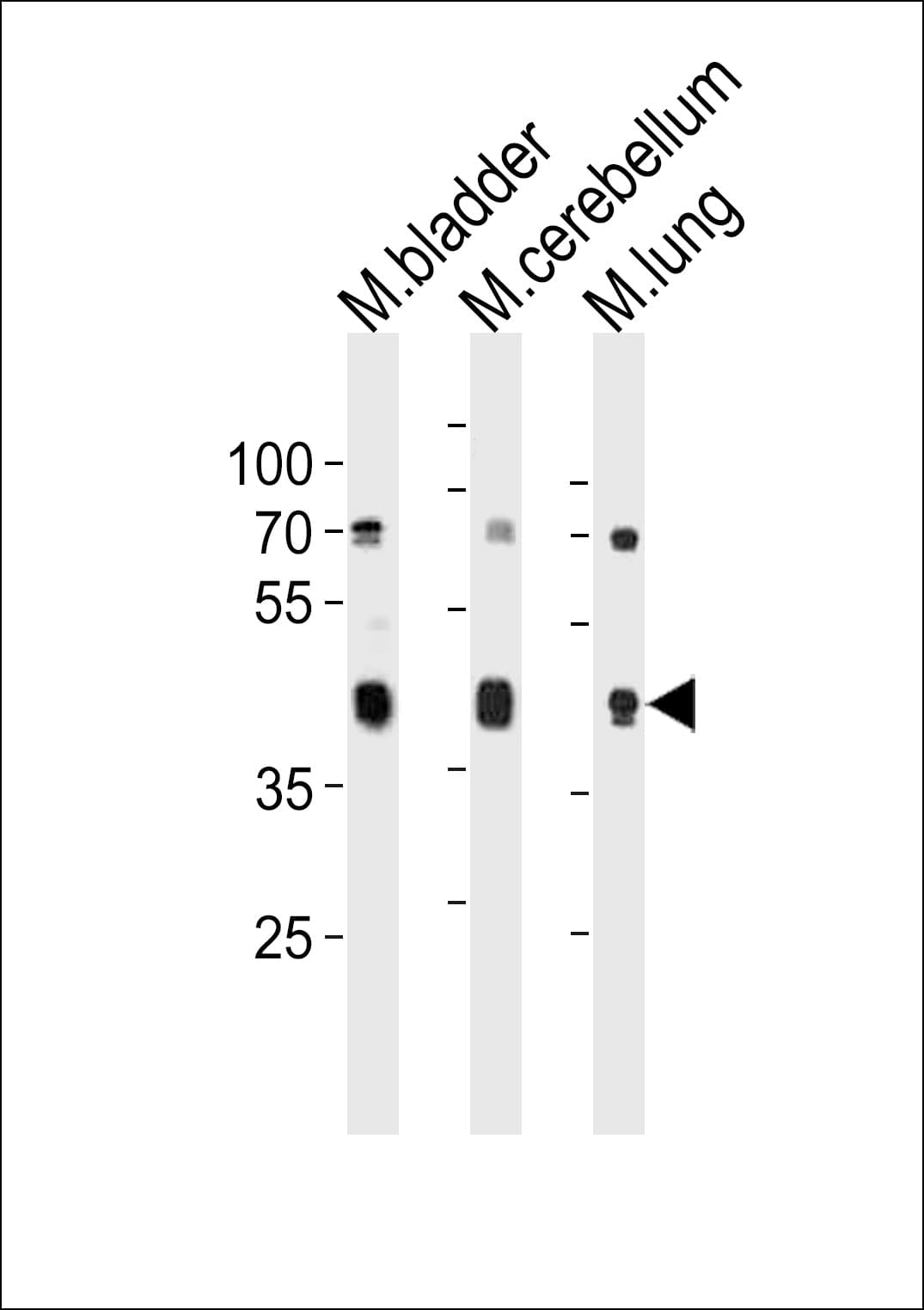 CCKAR / CCK1R Antibody (aa325-356)