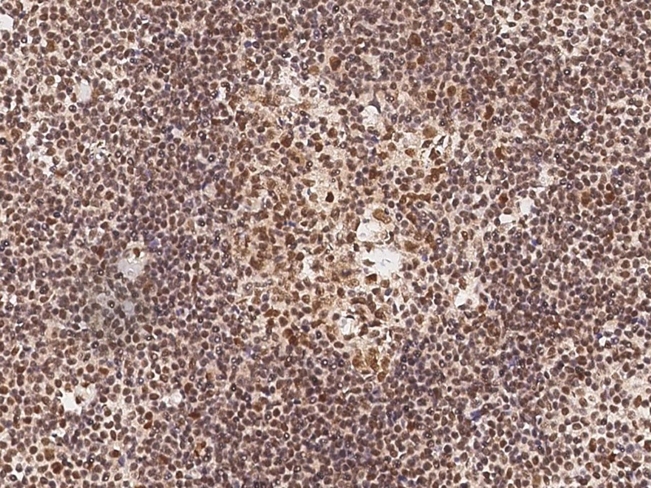 Polyclonal Rabbit anti-Human METTL21B / FAM119B Antibody (IHC, IF)