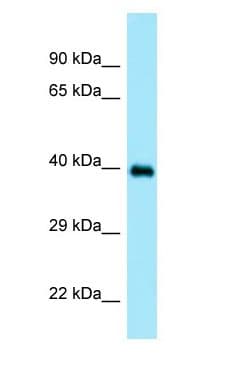 DOC2A Antibody (aa107-156)