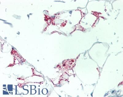 IHC-plus™ CXCL6 Antibody