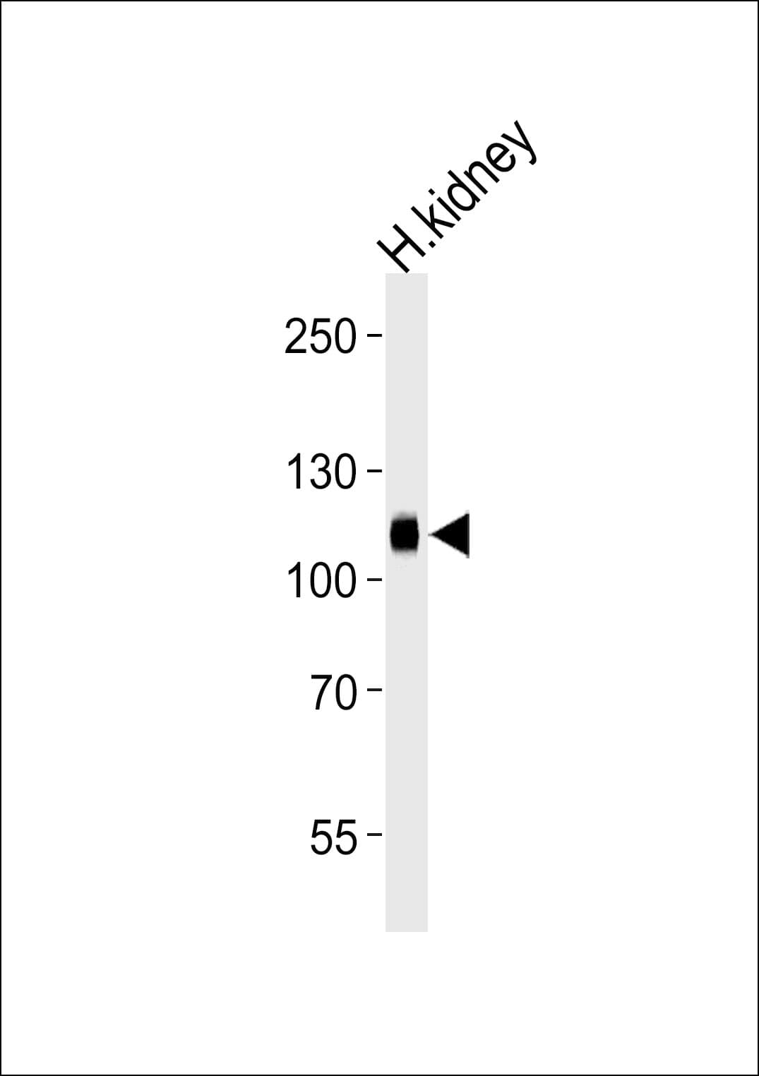 PHACTR4 Antibody (aa536-565)