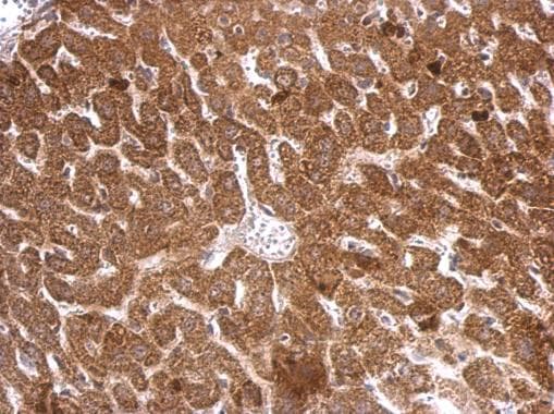 Polyclonal Rabbit anti-Human NOS2 / iNOS Antibody (aa115-304, IHC)