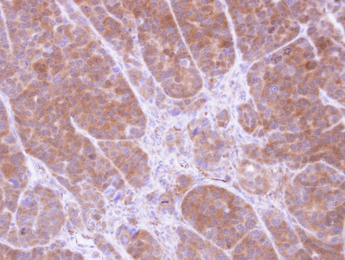 TPM2 Antibody (aa1-234)