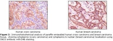 SNCG / Gamma-Synuclein Antibody (clone 1H10D2)