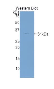 LRP6 Antibody (aa981-1213, Cy3)