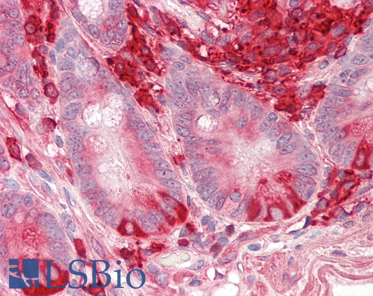 IHC-plus™ Polyclonal Goat anti-Human TXNDC5 / ERP46 Antibody (aa281-295, IHC, WB)
