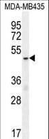 MECP2 Antibody (aa58-87)