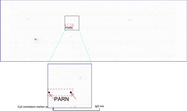 PARN Antibody (aa1-266, clone UMAB143, Carrier-free)