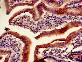Polyclonal Rabbit anti-Human PITX2 / RGS Antibody (IHC, IF, WB)
