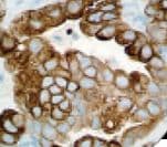 KRT7 / CK7 / Cytokeratin 7 Antibody (clone OV-TL 12/30, Ready-to-Use)