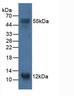 BCMP84 / S100A14 Antibody (aa1-91, Biotin)