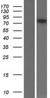 FOXP2 Protein (Over-Expression Lysate Myc-DDK (Flag))