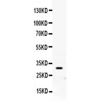 PRNP / PrP / Prion Antibody (aa143-230)