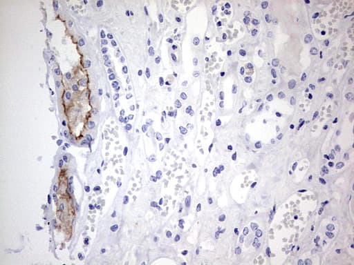 ABCB1 / MDR1 / P Glycoprotein Antibody (aa995-1280, clone OTI3C8)