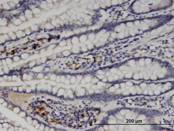GNT-V / MGAT5 Antibody (clone 3E9)