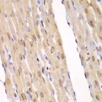 LIG3 / DNA Ligase III Antibody