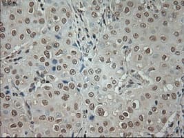 Monoclonal Mouse anti-Human GAD1 / GAD67 Antibody (clone OTI3G9, IHC, WB)