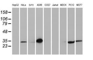 Latexin / MUM Antibody (clone OTI2G4, Carrier-free)