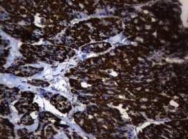 PathPlus™ HSPD1 / HSP60 Antibody (clone OTI3A2)