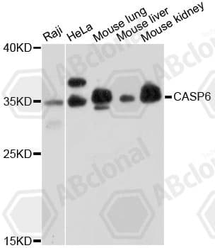Polyclonal Rabbit anti-Human CASP6 / Caspase 6 Antibody (IHC, WB)