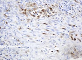 TP / Thymidine Phosphorylase Antibody (aa311-482, clone OTI1E7, Carrier-free)