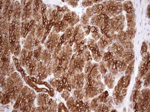 KRT18 / CK18 / Cytokeratin 18 Antibody (aa69-372, clone OTI3D1)