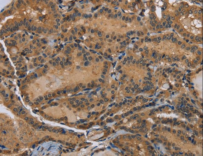 DNAJA1 / HDJ2 Antibody