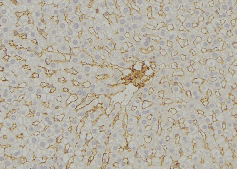 IMMP2L Antibody
