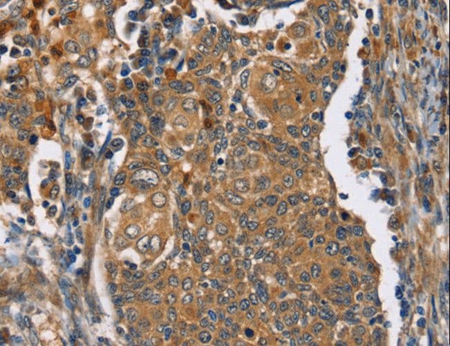 IHC-plus™ TAC1 Antibody