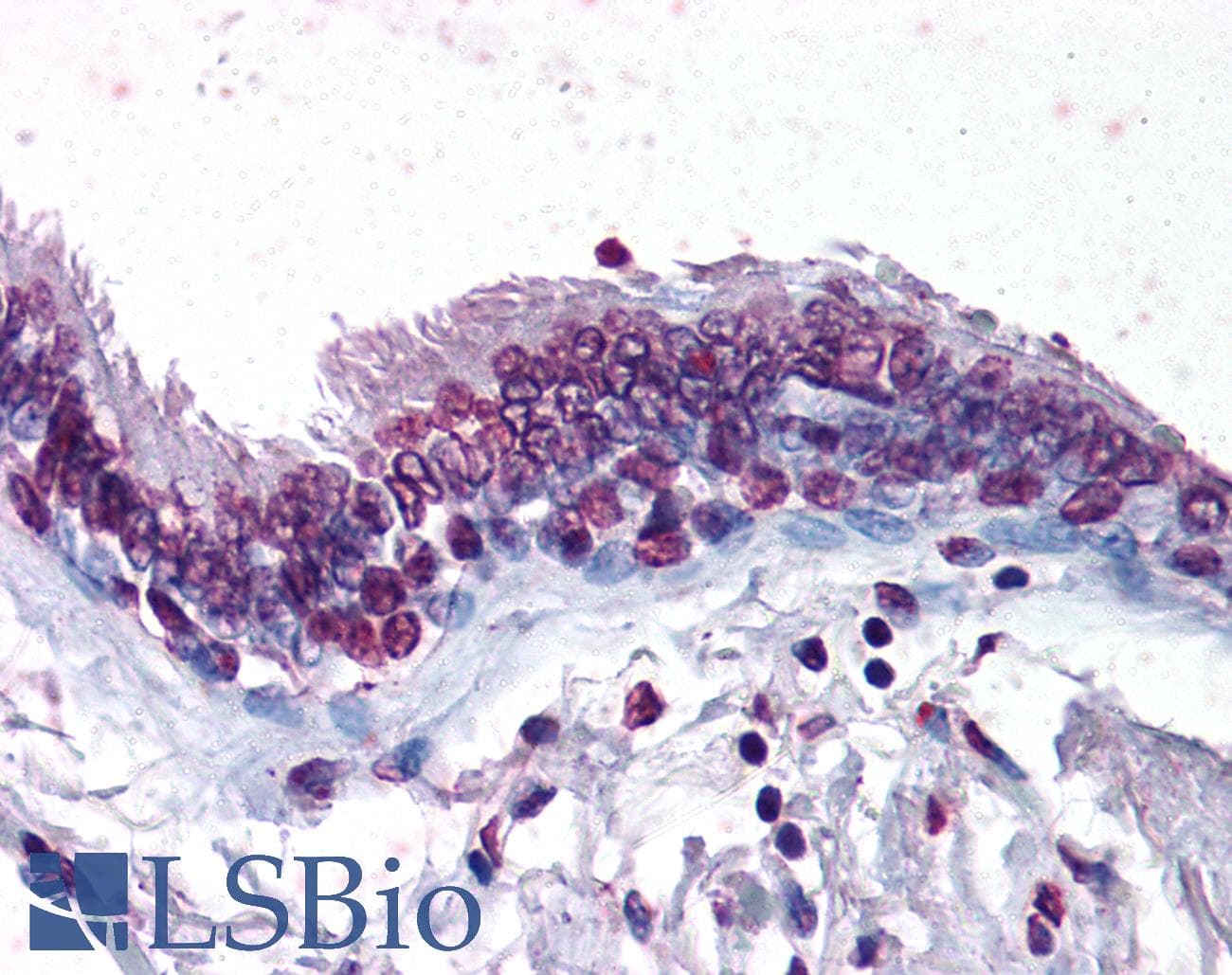 IHC-plus™ Monoclonal Mouse anti-Human TERT / Telomerase Antibody (clone 2D8, IHC)