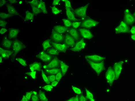 Polyclonal Rabbit anti-Human ATXN3 / JOS Antibody (IHC, IF, WB)