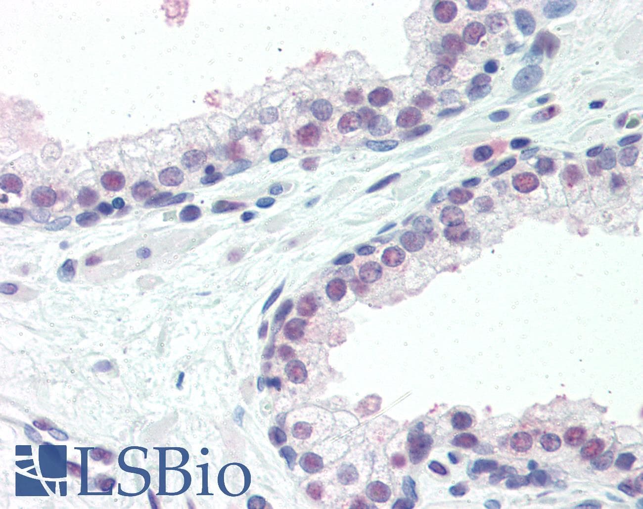 IHC-plus™ ISG15 Antibody (aa31-61)