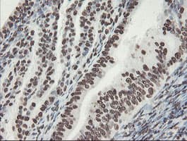 NONO / P54NRB Antibody (clone OTI2C9)