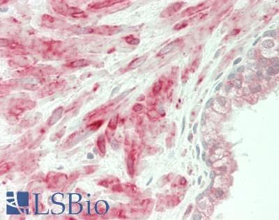 IHC-plus™ Polyclonal Rabbit anti-Human WFS1 Antibody (IHC, WB)