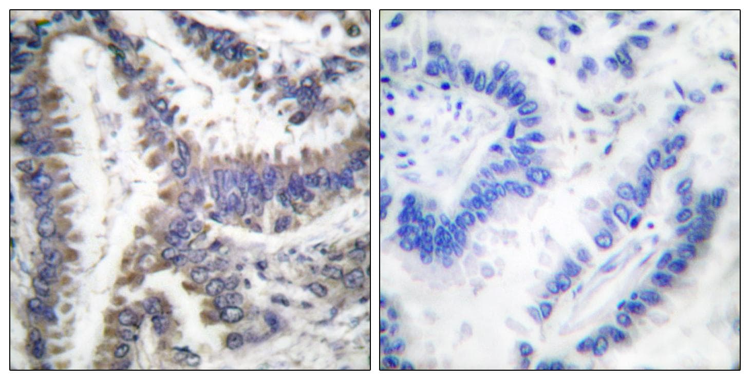 DFFA / ICAD / DFF45 Antibody (Cleaved-Asp224)