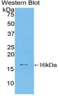 S100A6 / Calcyclin Antibody (aa1-90, PE)