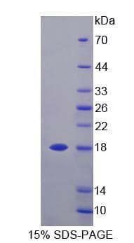 Mouse GLOD2 / MCEE Protein (Recombinant His, N-Terminal)