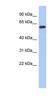 Polyclonal Rabbit anti-Human KLHL7 Antibody (C-Terminus, WB)