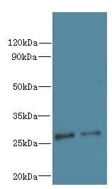 Polyclonal Rabbit anti-Human C7orf62 Antibody (IHC, WB)