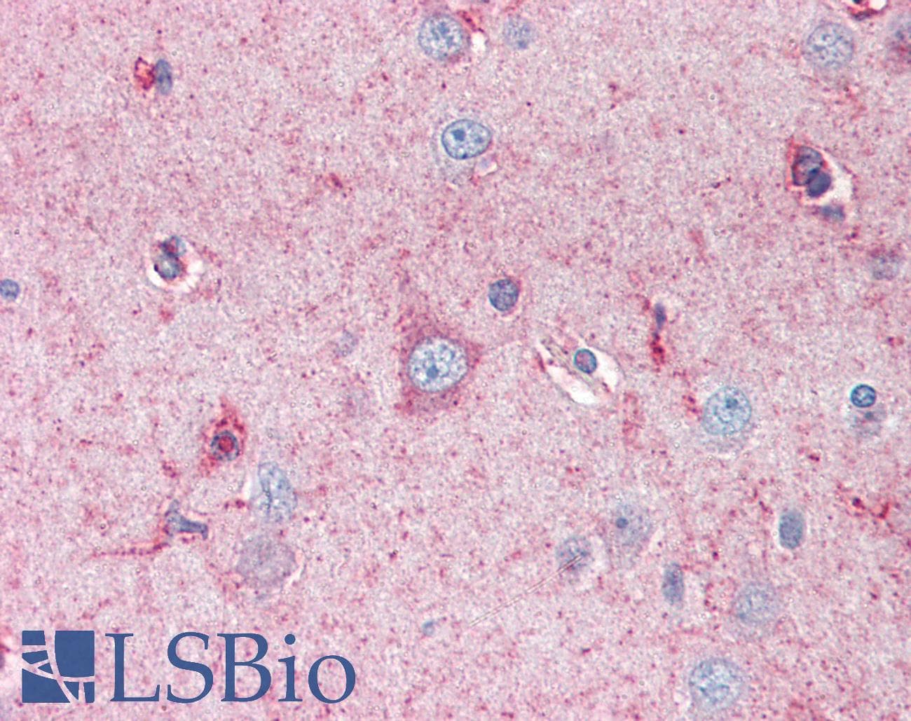 IHC-plus™ Polyclonal Rabbit anti-Human SLITRK1 Antibody (IHC, IF, WB)