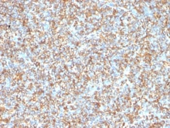 Vimentin Antibody (clone VM1170)