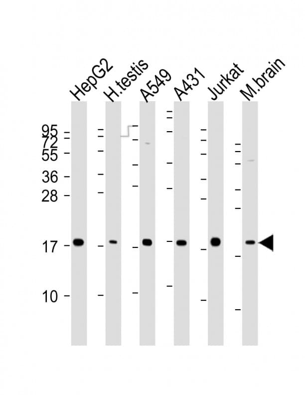 EEF1E1 / AIMP3 Antibody (clone 1494CT639.147.31)