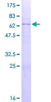 Human CTSV / Cathepsin V Protein (Recombinant GST)