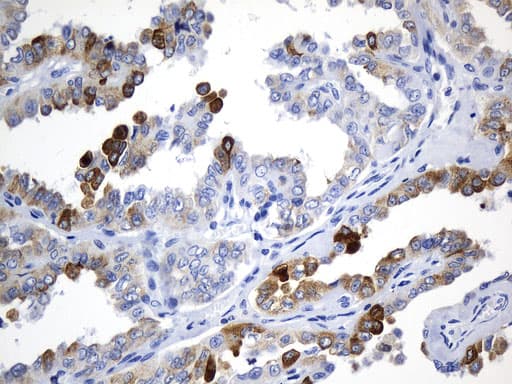 AGR2 Antibody (aa21-175, clone UMAB245, Carrier-free)
