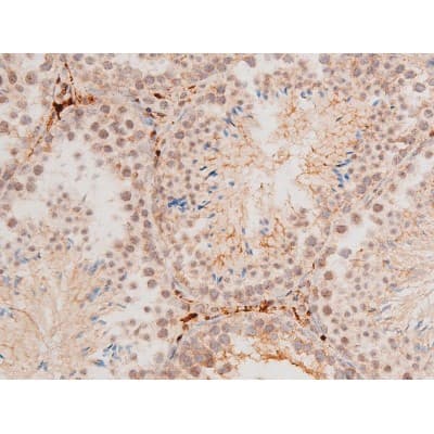 MAPK8 / JNK1 Antibody (phospho-Thr183,pTyr185)