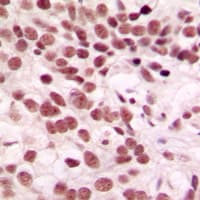 CTDSP1 / SCP1 Antibody (N-Terminus)