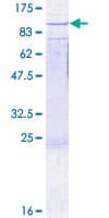 Human RAD17 Protein (Recombinant GST)