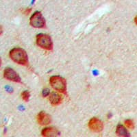 MINK1 / MINK Antibody (Internal)