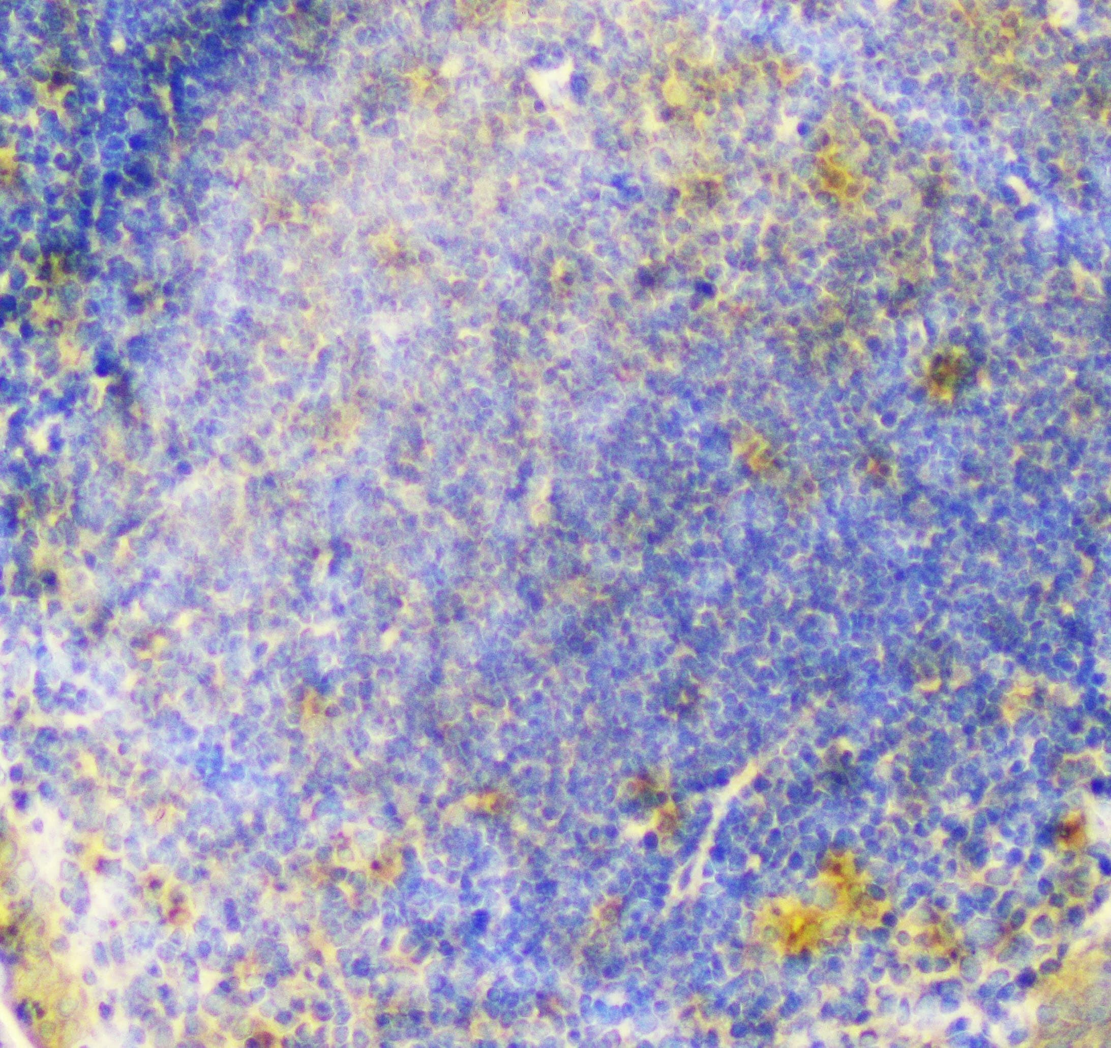 PDCD6IP / ALIX Antibody (aa2-330)